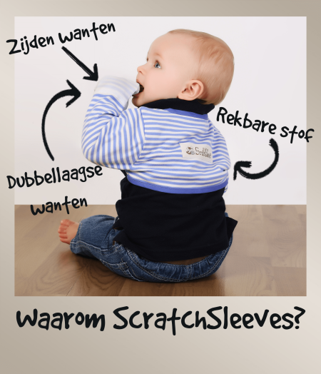 Peuterjongen met blauwe en witte ScratchSleeves-krawanten, geannoteerd om te laten zien hoe ze werken om krabben door eczeem te verminderen