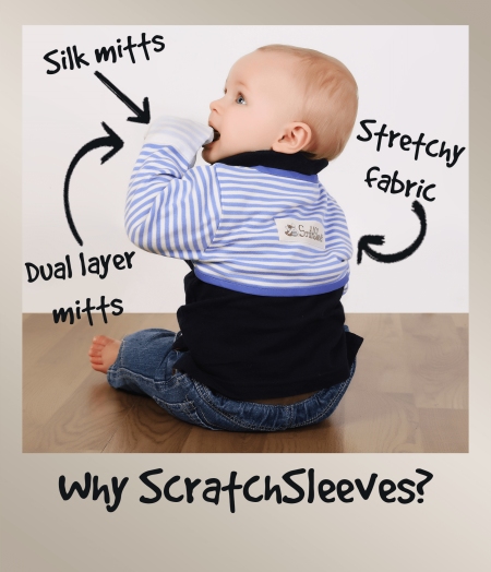 Toddler boy wearing blue and white ScratchSleeves scratch mittens, annotated to show how they work to reduce eczema scratching